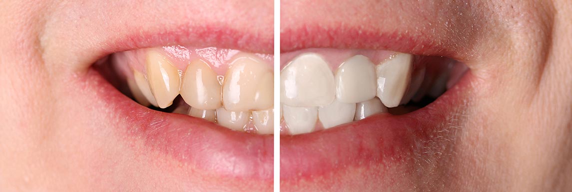 dentista Monza odontoiatria estetica